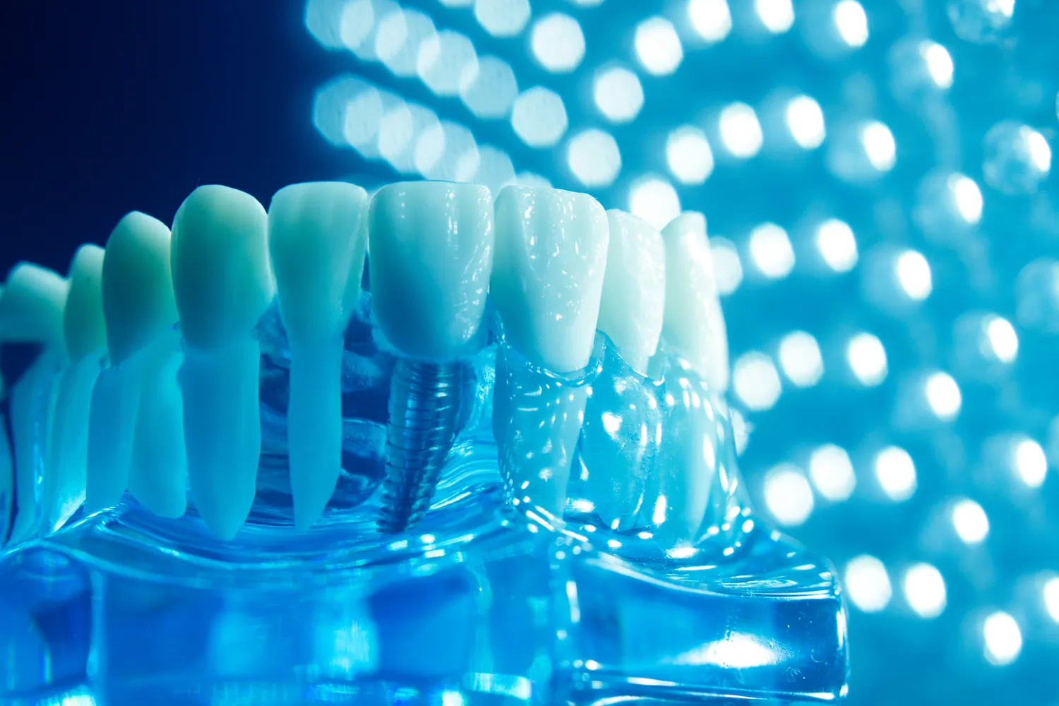 Protetyka zębów Warszawa