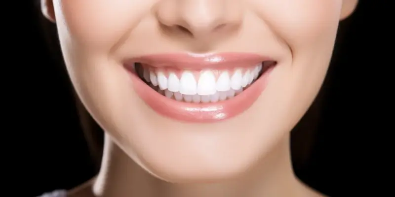 Licówki porcelanowe kiedy zdecydować się na założenie?