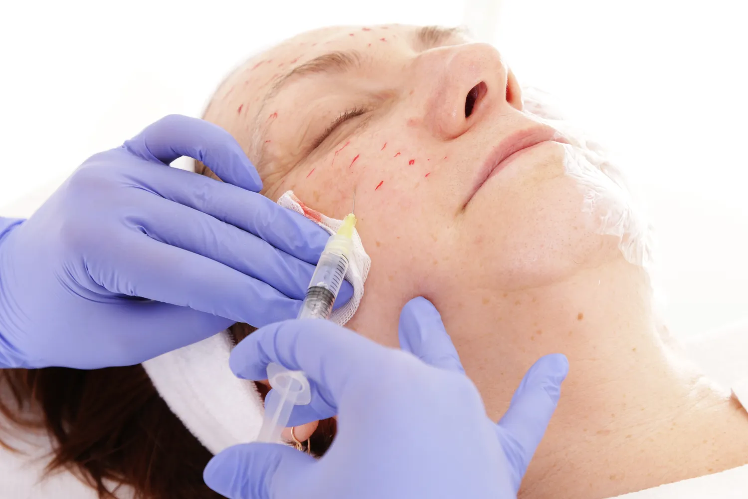 Czy botoks jest szkodliwy?