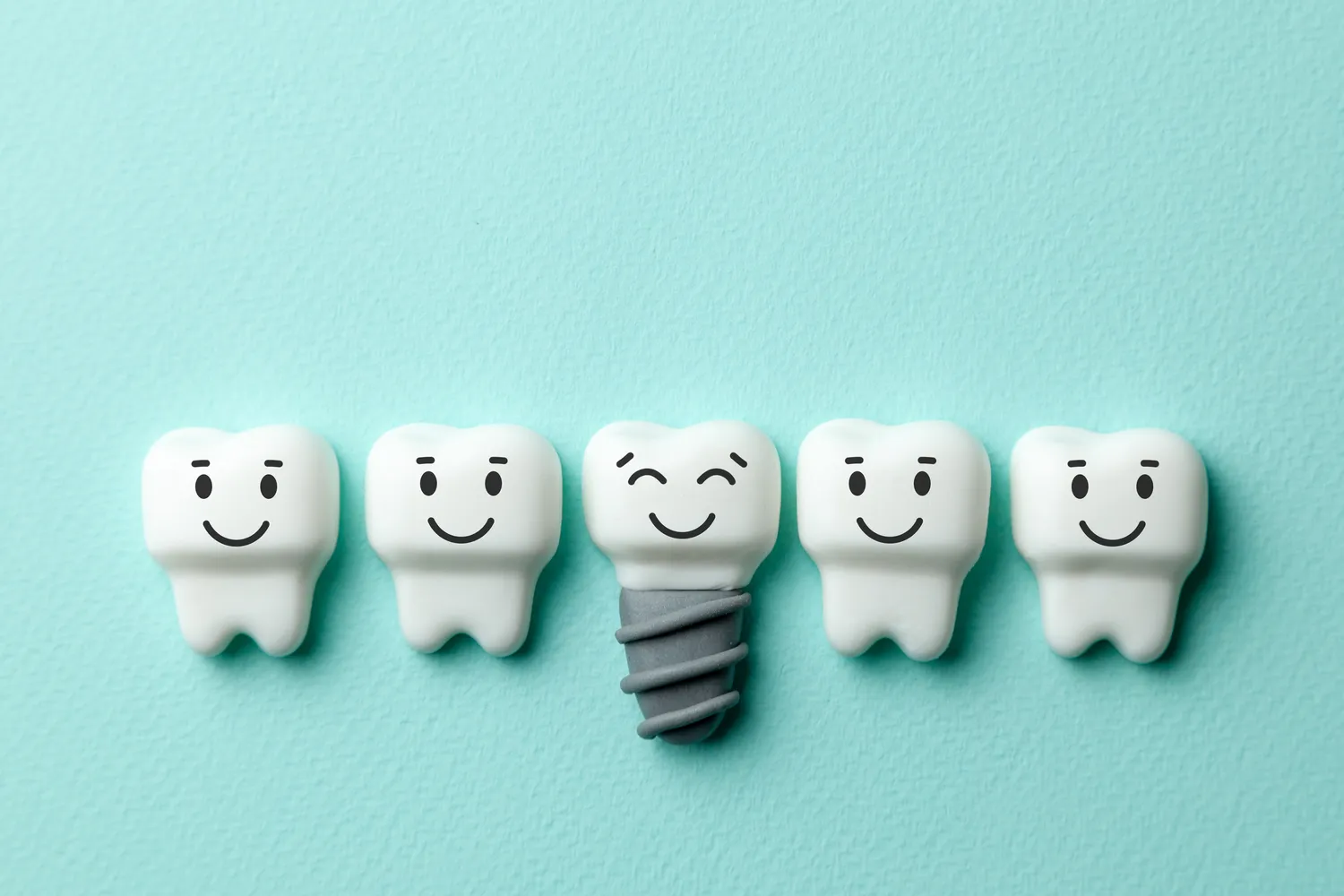 Implanty zębów - ile kosztuje wstawienie zęba?